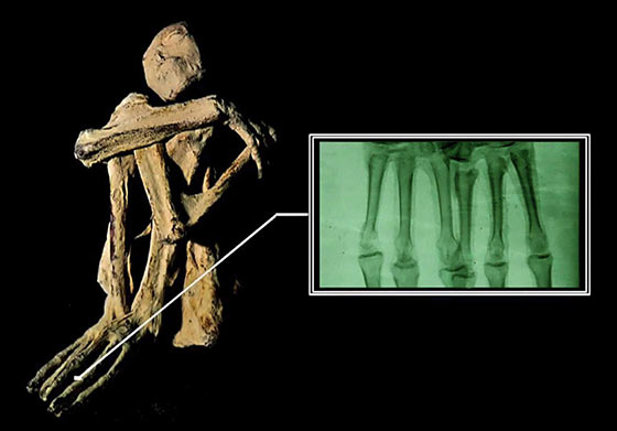 momia34Le incredibili mummie di Nazca560